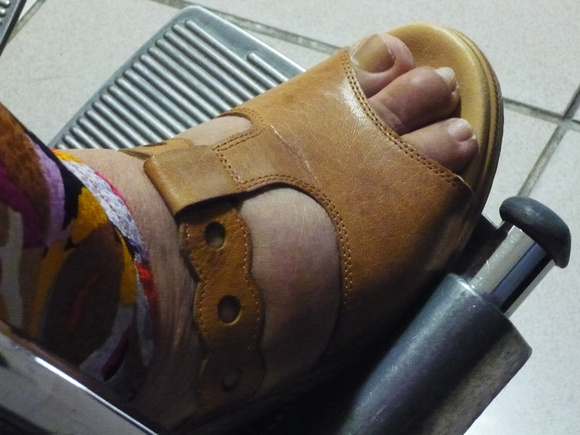 Mak Hospital Visit - Fractured Foot Bone
