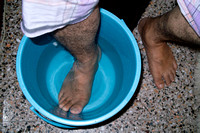 Hussien having swollen feet