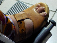 Mum's Hospital Visit - Foot Fracture